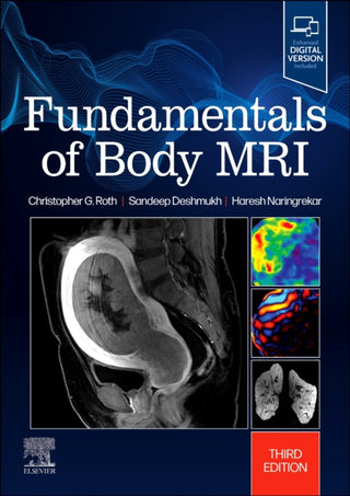Cover image for 9780323833813 - Fundamentals of Body MRI