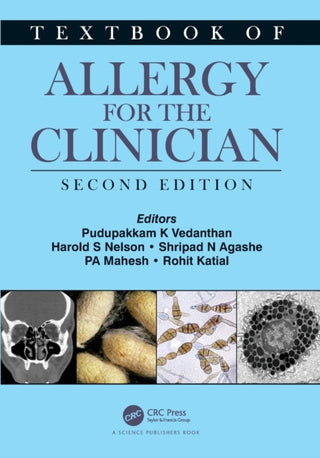 Supplemental image for 9780367642419 - Textbook of Allergy for the Clinician