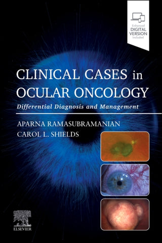 Cover image for 9780443120497 - Clinical Cases in Ocular Oncology