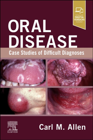 Cover image for 9780443280900 - Oral Disease: Case Studies of Difficult Diagnoses