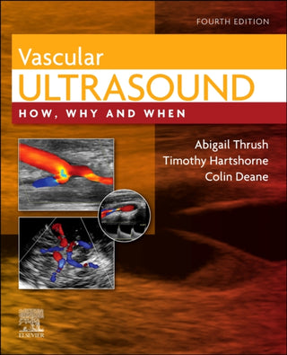 Supplemental image for 9780702046568 - Vascular Ultrasound