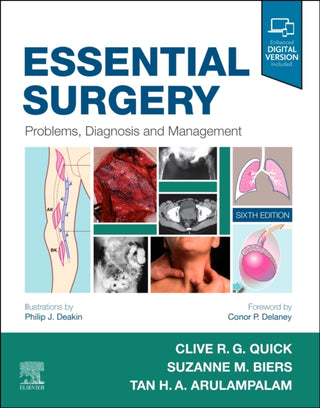 Supplemental image for 9780702076312 - Essential Surgery