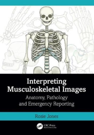 Cover image for 9781032398914 - Interpreting Musculoskeletal Images
