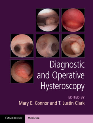 Cover image for 9781107111608 - Diagnostic and Operative Hysteroscopy