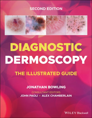 Cover image for 9781118930489 - Diagnostic Dermoscopy – The Illustrated Guide, 2e