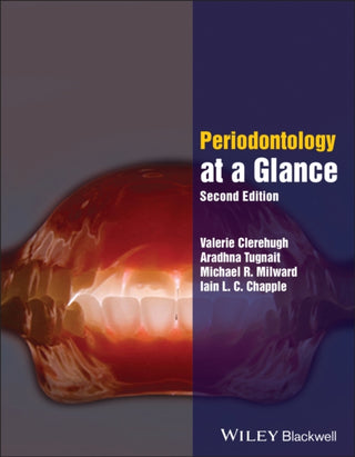 Supplemental image for 9781118988428 - Periodontology at a Glance
