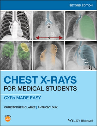 Cover image for 9781119504153 - Chest X-Rays for Medical Students