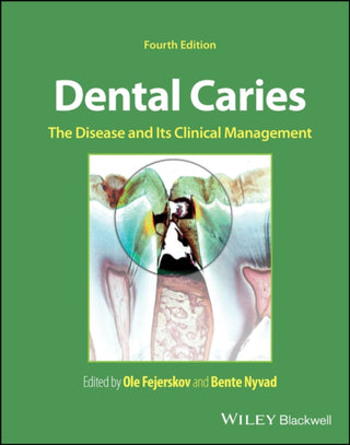 Cover image for 9781119679370 - Dental Caries