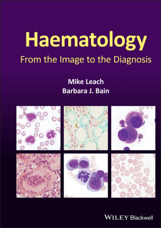 Cover image for 9781119777502 - Haematology – From the Image to the Diagnosis
