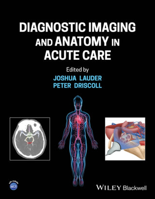 Cover image for 9781119809449 - Diagnostic Imaging and Anatomy in Acute Care