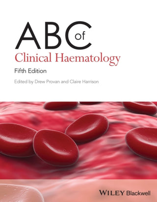 Supplemental image for 9781119890744 - ABC of Clinical Haematology