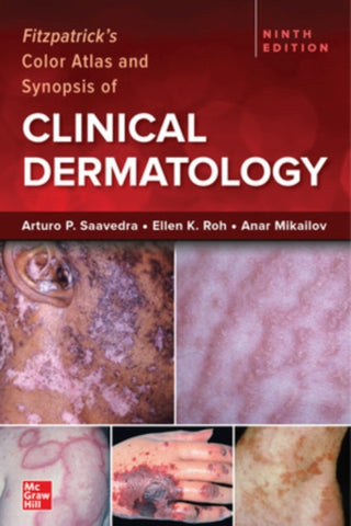 Supplemental image for 9781264278015 - Fitzpatrick's Color Atlas and Synopsis of Clinical Dermatology, Ninth Edition