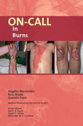 Cover image for 9781911450849 - On-Call in Burns