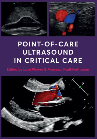 Cover image for 9781911510994 - Point-of-Care Ultrasound in Critical Care