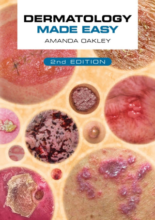 Supplemental image for 9781914961168 - Dermatology Made Easy, second edition