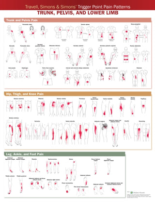 Supplemental image for 9781975183851 - Travell, Simons & Simons’ Trigger Point Pain Patterns Wall Chart