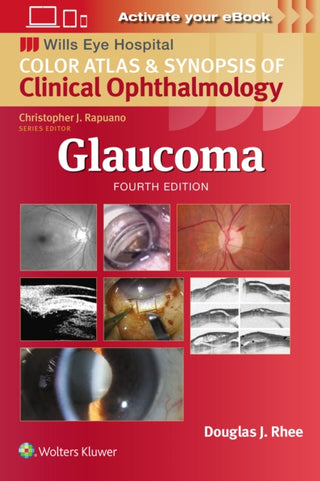 Cover image for 9781975214814 - Glaucoma
