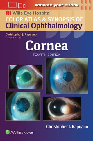 Supplemental image for 9781975214975 - Cornea: Print + eBook with Multimedia