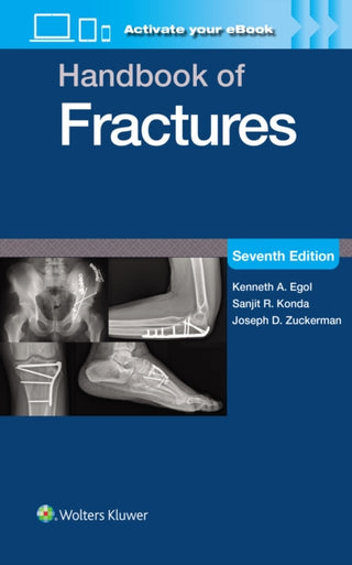 Cover image for 9781975217990 - Handbook of Fractures: Print + eBook with Multimedia