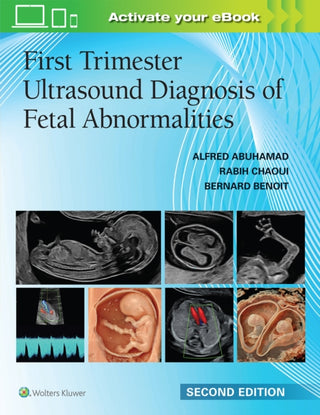 Cover image for 9781975242831 - First Trimester Ultrasound Diagnosis of Fetal Abnormalities