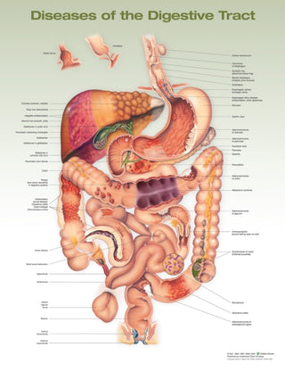 Cover image for 9781975243258 - Diseases of the Digestive Tract Anatomical Chart