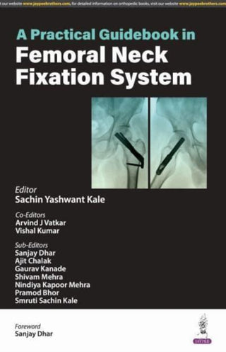 Cover image for 9789356965959 - A Practical Guidebook in Femoral Neck Fixation System