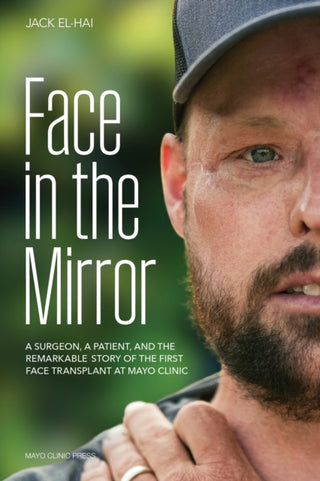 Cover image for 9798887700281 - Face Transplant