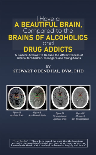 Cover image for 9798889109891 - I Have a Beautiful Brain, Compared to the Brains of Alcoholics and Drug Addicts
